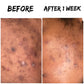 dark spot corrector, skincare , acne prone skin, glow juice, skin envy beauty bar